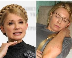 ГПУ: Тимошенко не может лечиться в России