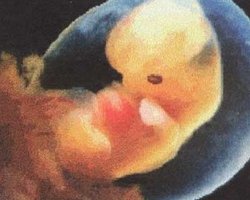 Пара из США создала аккаунт в Facebook еще не рожденной дочери