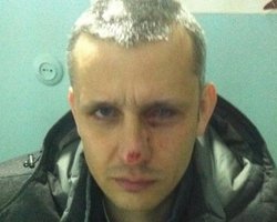 В Киеве погиб корреспондент "Вестей" Вячеслав Веремий