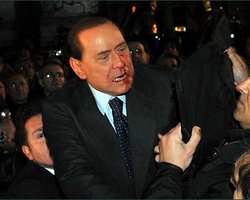 Берлускони прооперировали ударенную маньяком челюсть