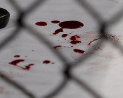 На Буковине застрелился кандидат в депутаты, занявший на выборах последнее место 