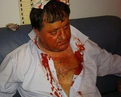 В парламентской драке бютовцу рассекли голову, его госпитализировала скорая