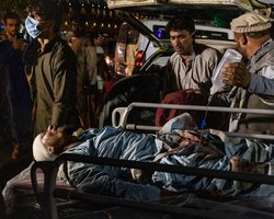 "Сегодня я видел конец света": выживший после взрывов в Кабуле рассказал о пережитом (видео)