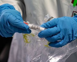 Старая школа. Китайская вакцина с "мертвым" коронавирусом сработала на обезьянах