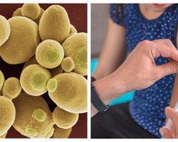 "Украинское ноу-хау": во Львове разрабатывают вакцину от коронавируса на дрожжах