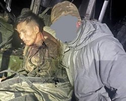 Мог получить ранение: Южная Корея подтвердила, что ВСУ взяли в плен первого солдата из КНДР