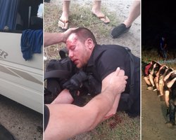 Репетиция террора или шоу: что известно о нападении на "патриотов за жизнь" под Харьковом