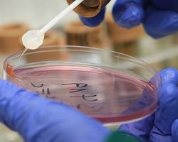Кишечная инфекция E.coli добралась до Бразилии