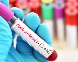 Гірший за "Дельту". В Україні зафіксований більш небезпечний штам коронавірусу