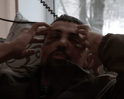 "Думав, знесло пів обличчя": актор Лінартович розповів, як отримав поранення в Соледарі (відео)