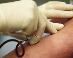 В Германии возросло число жертв кишечной инфекции