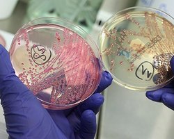 Кишечная инфекция обнаружена у границ Украины, - СМИ