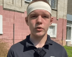 В голову потрапило 3 осколки: хлопчик розповів, як рятував людей з палаючого автобуса в Сумах
