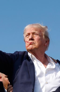 Интерес Байдена и украинский след: что будут раскручивать в связи с покушением на Трампа