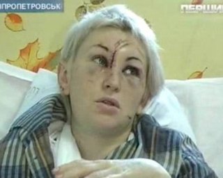 Выжившие в ДТП под Марганцем: водитель хотел проскочить переезд