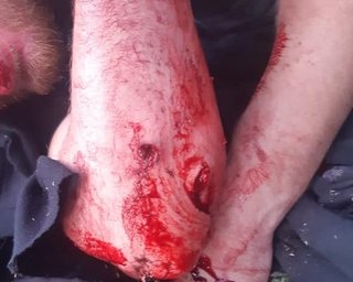Прокуратура считает нападение на автобус под Харьковом покушением на убийство
