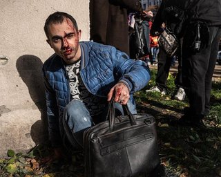 У лікарнях досі перебуває 35 киян, які постраждали від обстрілу 10 жовтня, – Кличко