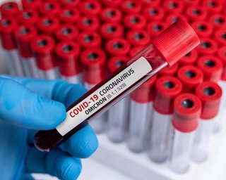 Дослідники перерахували основні симптоми штаму Омікрон