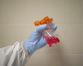 В Запорожской области – 6 заболевших калифорнийским гриппом