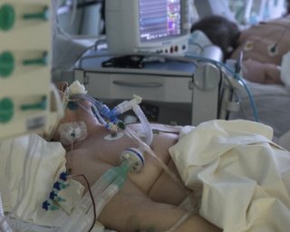 Статистика коронавірусу на 18 квітня: померли 250 осіб, число нових випадків продовжує скорочуватися