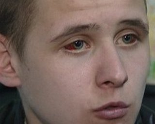 Харьковская милиция избила парня. Возбуждено уголовное дело