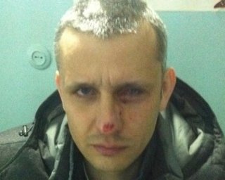 В Киеве погиб корреспондент "Вестей" Вячеслав Веремий