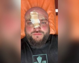У Затоці жорстоко побили ветерана АТО: у поліції уточнили, ким насправді є потерпілий