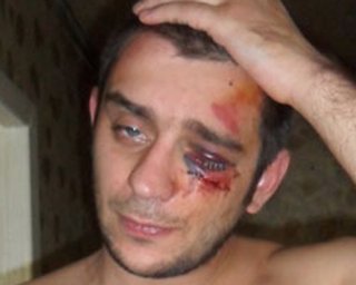 В Донецке милиционеры избили журналиста 