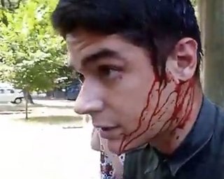 Полиция: Задержаны подозреваемые в покушении на лидера одесского Автомайдана