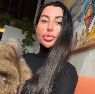 "Схоже на праску": українка налякала людей своїм "квадратним" обличчям (відео)