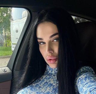 "Главная ведьма Украины" сделала сразу три пластические операции (фото)