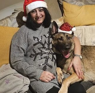 Женщине ампутировали все конечности после того, как ее "облизала собака": сепсис едва не стоил жизни