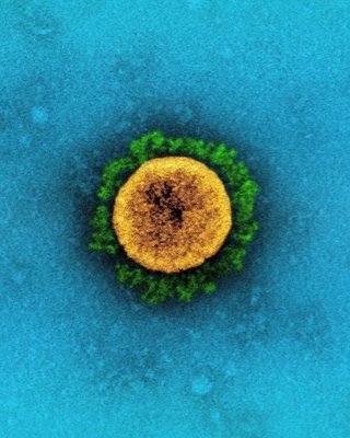 Штам коронавірусу Йота: що про нього відомо