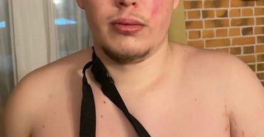 "Мы все здесь контуженные": на Киевщине охранники избили ветерана ВСУ с нервным расстройством, — СМИ