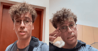 "Мене збила машина": Максим Галкін показав, що з ним сталося після ДТП (відео)