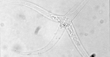 У 100 разів менша за піщинку: яка найменша тварина існує на Землі (фото)