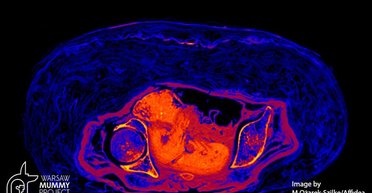 Беременная египетская мумия: ученые выяснили, как сохранился плод возрастом 2 тыс. лет