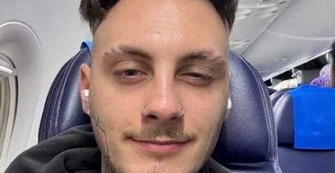 Будет возвращать "доброе имя": украинский блогер, которого выдворили из Польши, подал иск на поляков