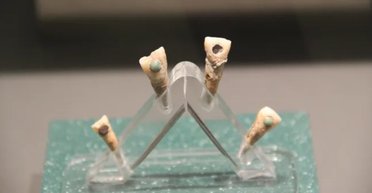 "Зубной камень" из зеленого нефрита: на зубах 7-летнего ребенка майя нашли необычное украшение