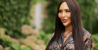 Українка з найбільшими вилицями розповіла про свої пластичні операції (відео)