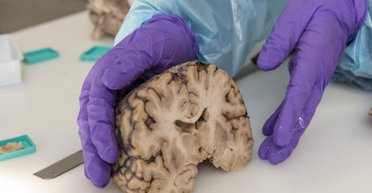 Мозок людей істотно виріс за останні десятиліття: що відбувається