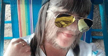 "Найбільш волохата дівчина у світі" кардинально змінила образ: тепер її не впізнати (фото)