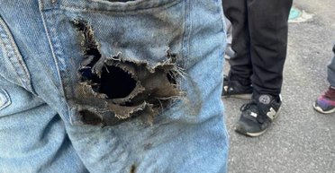 Деталь от "Шахеда" прожгла штаны: на Киевщине пострадал подросток (фото)