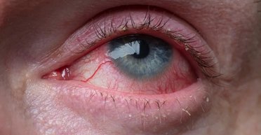 Более 60 лет назад подросток подбросил монетку и не спал 11 дней: последствия весьма тревожны