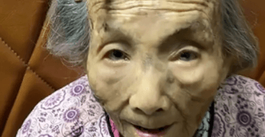 Секрет долголетия: женщина из Китая 107 лет живет с "дьявольским рогом" на лбу (фото)