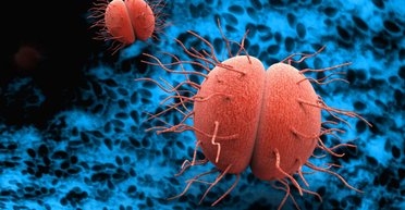 Життя під мікроскопом. Як випускник Могилянки став одним з основоположників мікробіології