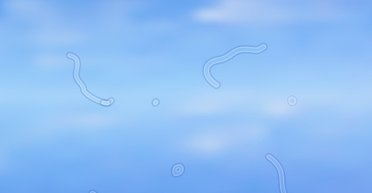 Исследователи объяснили, почему перед глазами появляются "летающие мушки"