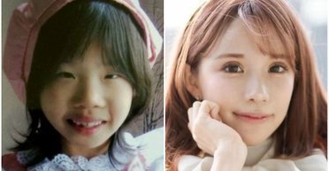 Пластична операція вартістю $140 тисяч повністю змінила життя дівчини (фото)