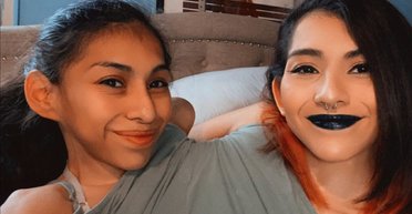 Одна кровеносная система и два мозга: как живут в одном теле близнецы Кармен и Лупита (фото, видео)