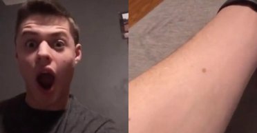 Чоловік поділився незвичайною теорією про веснянки на руках: що це означає (відео)